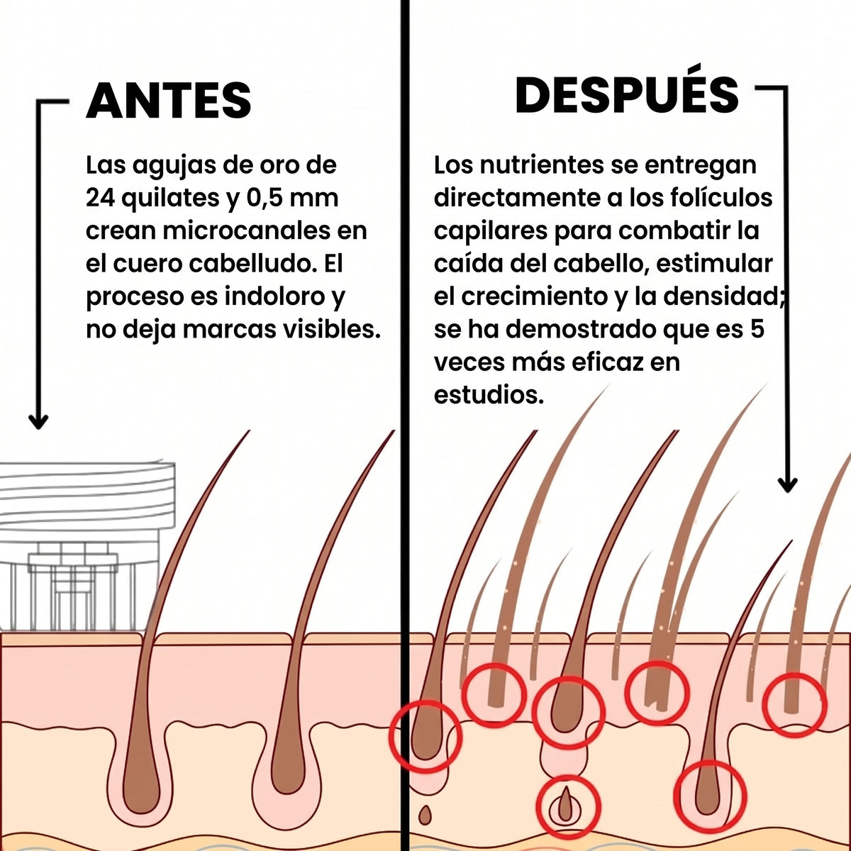 Kivarea™ Sistema de Regeneración Capilar