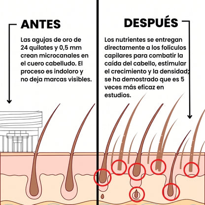 Kivarea™ Sistema de Regeneración Capilar